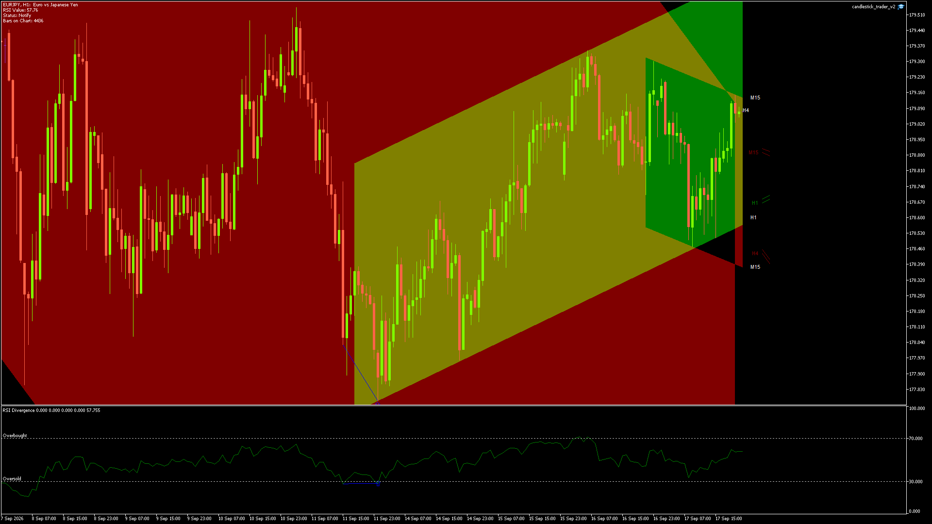 EURJPY candlestick chart showing current price action and technical levels